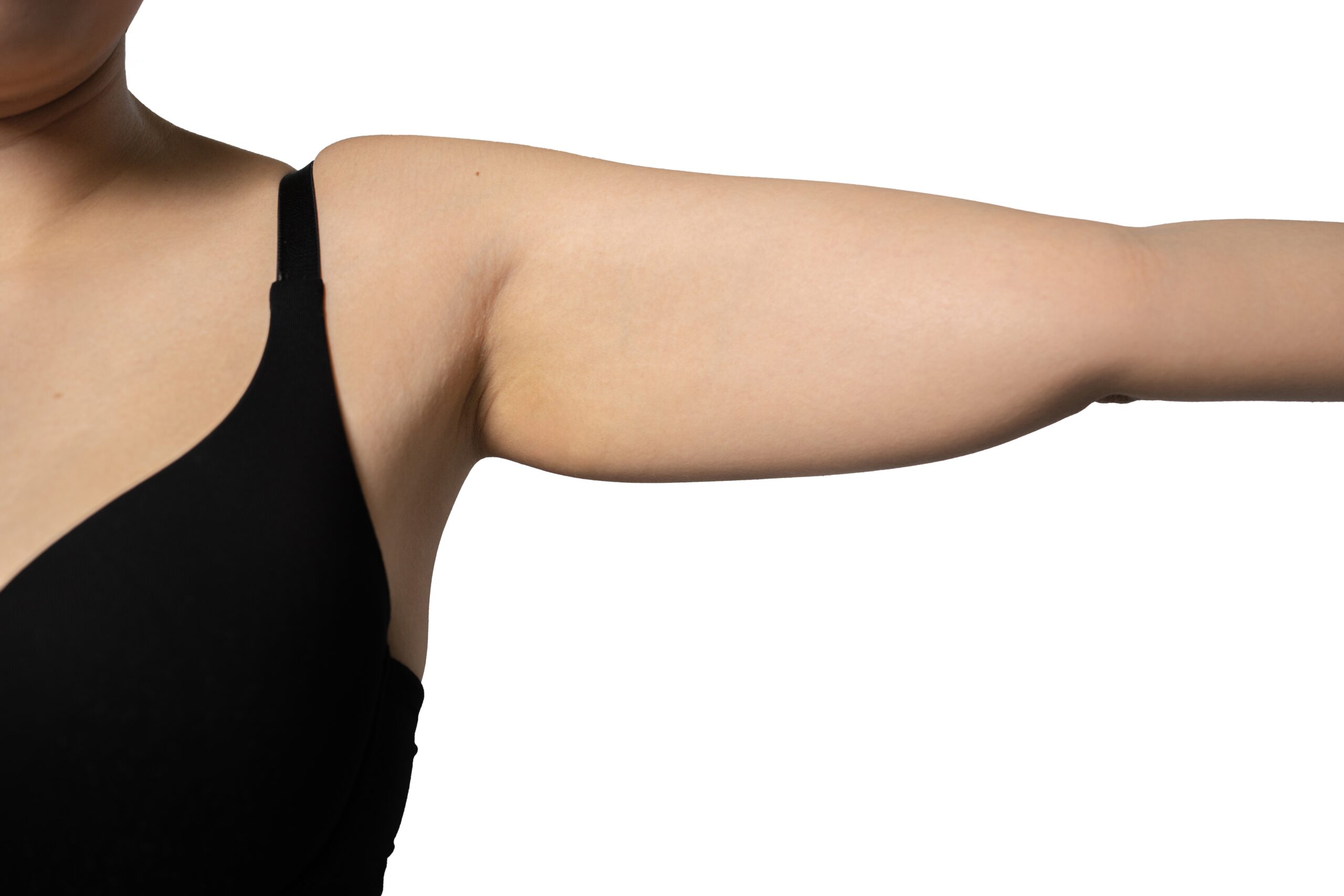 how to avoid loose skin when losing weight on glp-1 Arm Lift and Thigh Lift After GLP-1 Weight Loss: How to Address Loose Skin
